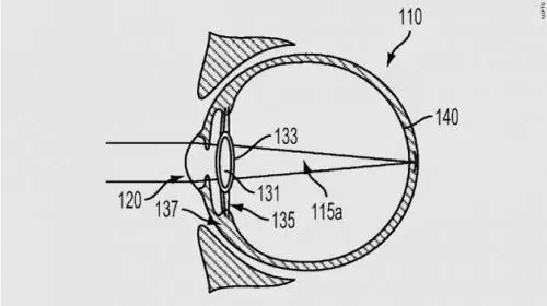 科技 | 谷歌把“電子眼注入眼球”，專利申請能否通過？